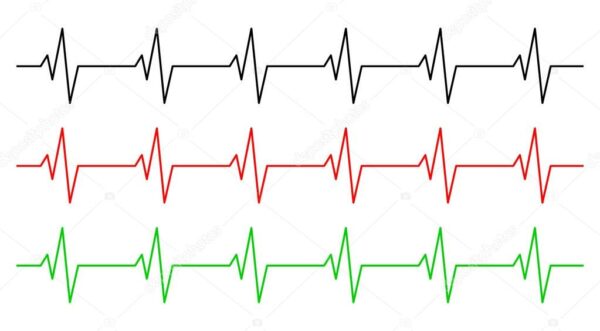 ECG